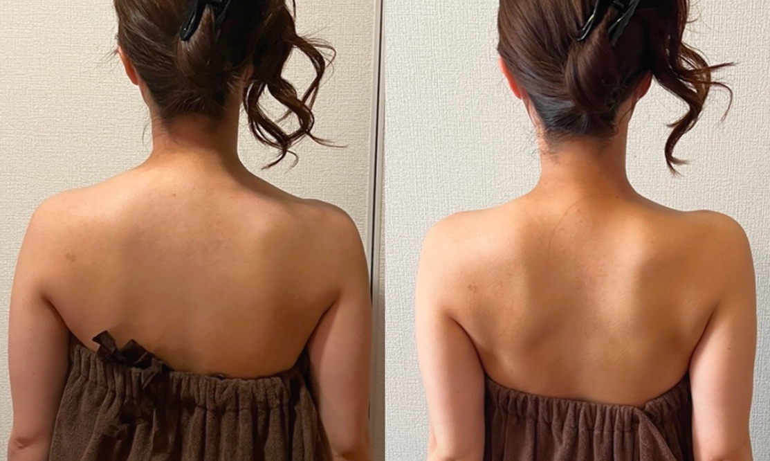 カウンセリング