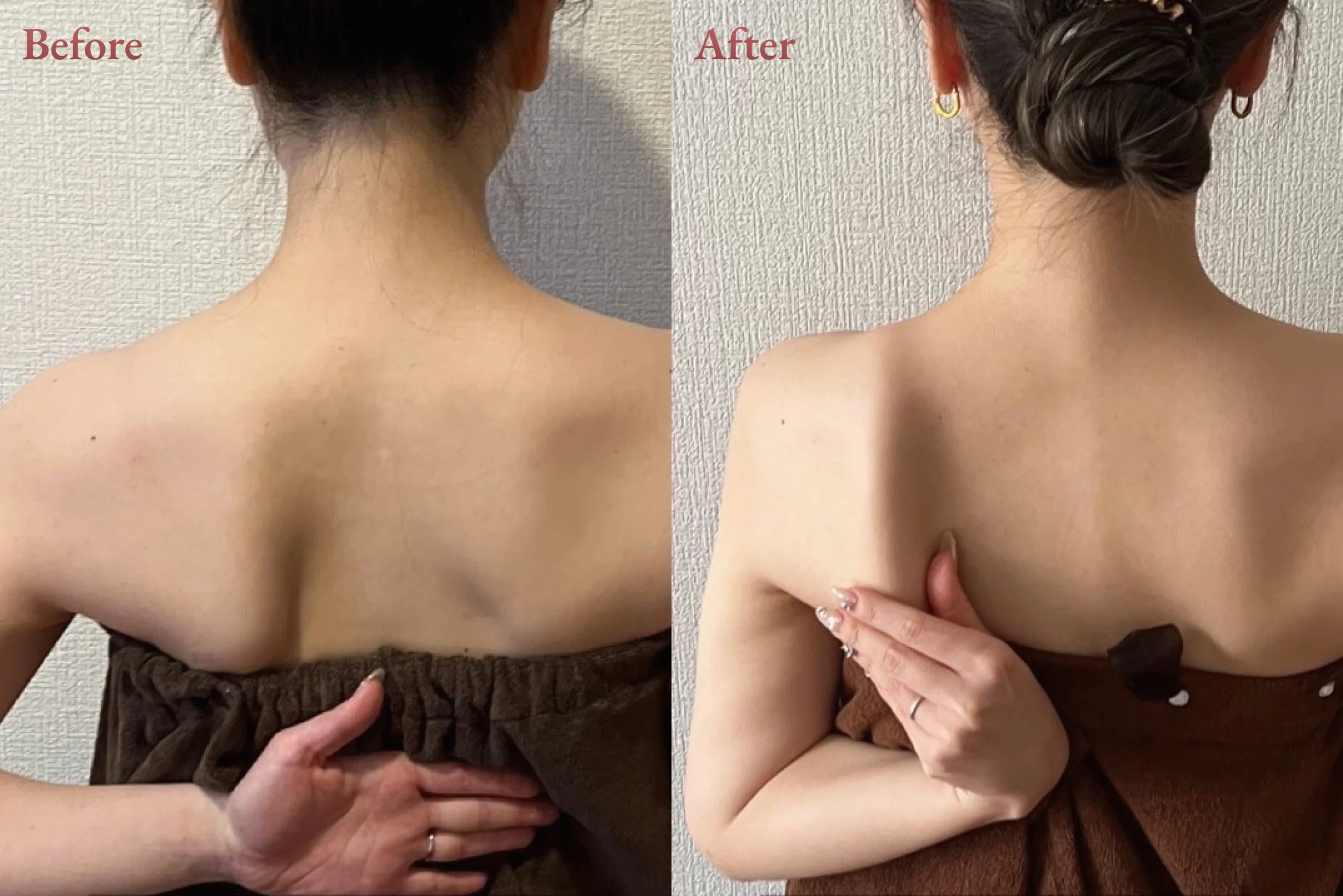 20代 - 翼を授ける肩甲骨はがしコース - 施術回数3回