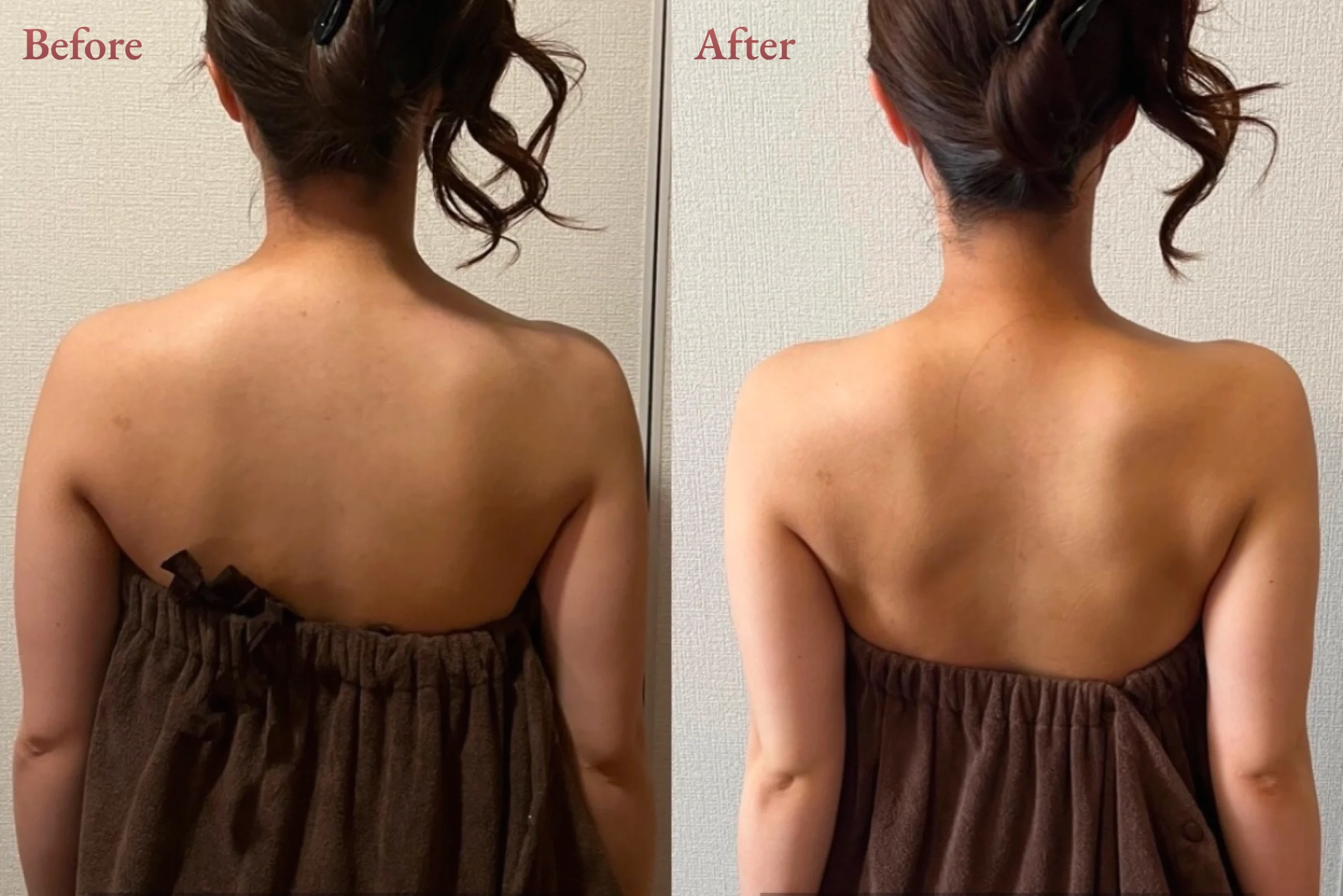 30代 - 肩甲骨はがし＋オイルマッサージ - 施術回数3回