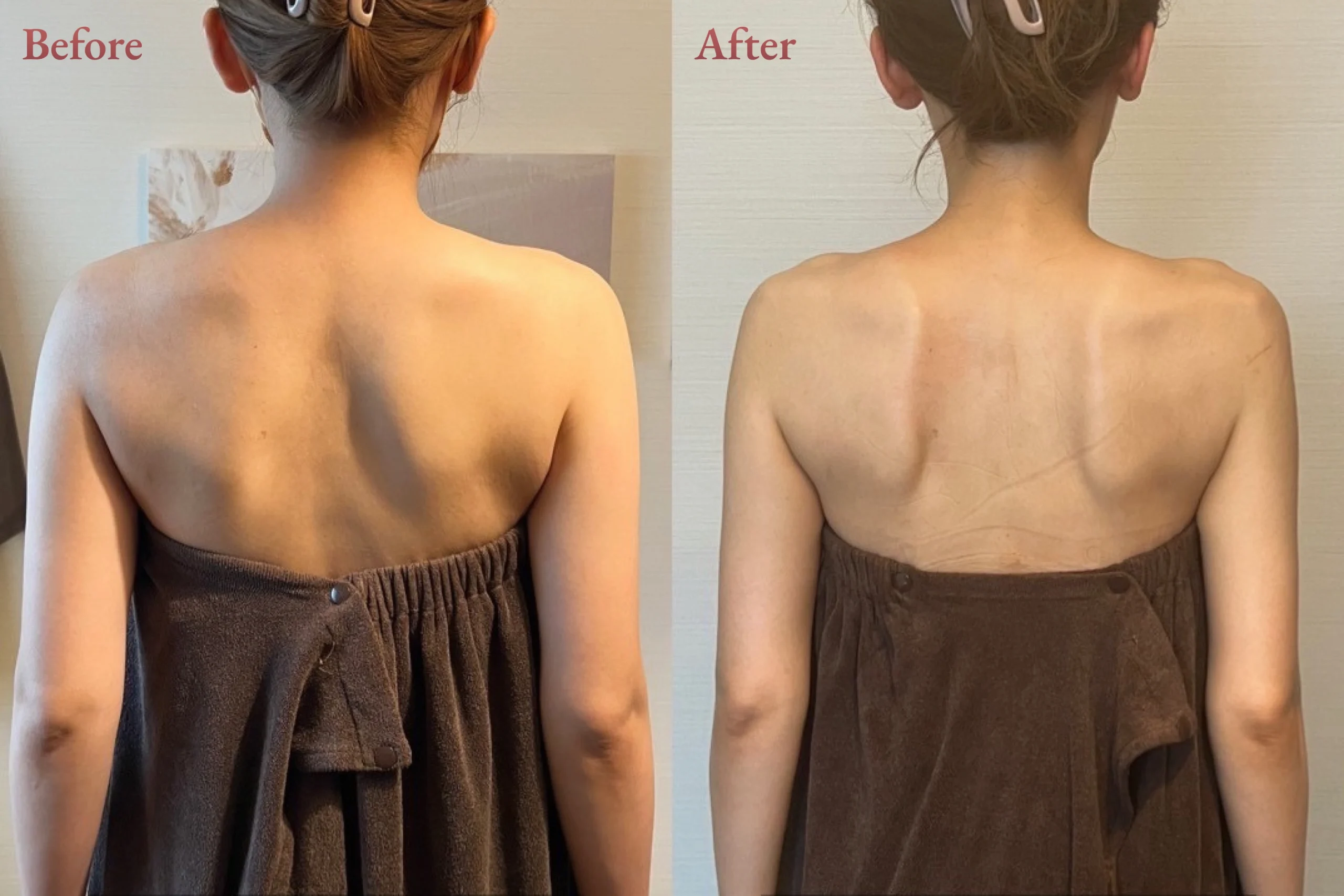 20代 - ブライダル整体 - 施術回数5回